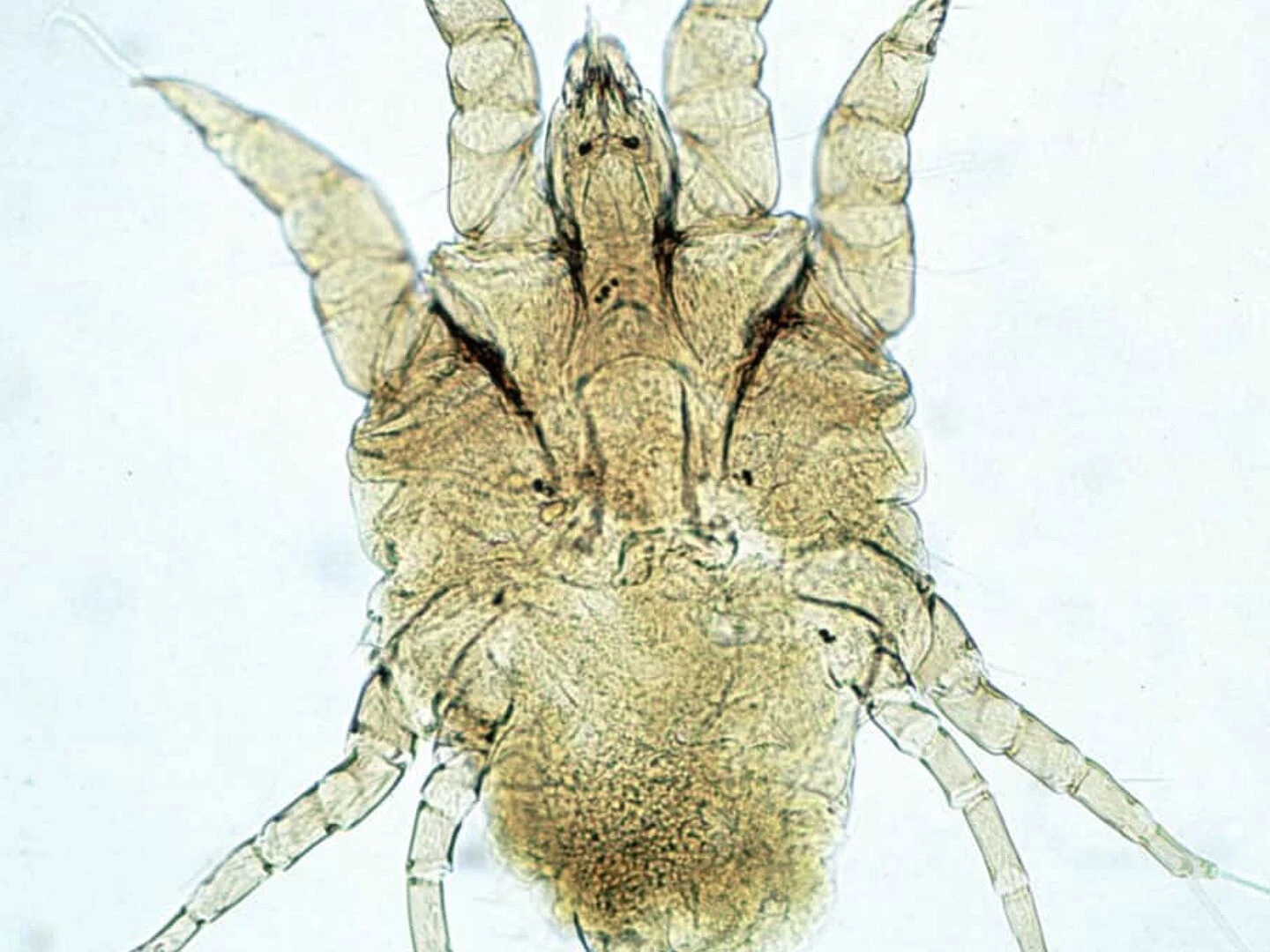 chorioptic sarcoptic mite