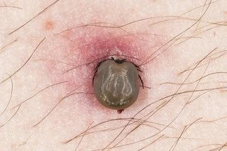 tick